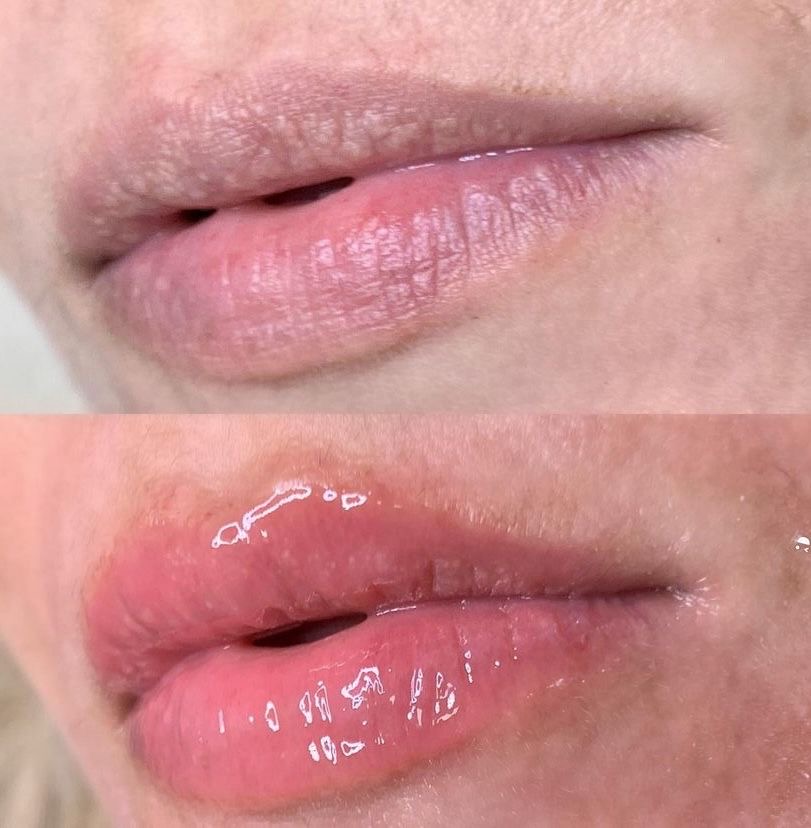 Hydra Gloss