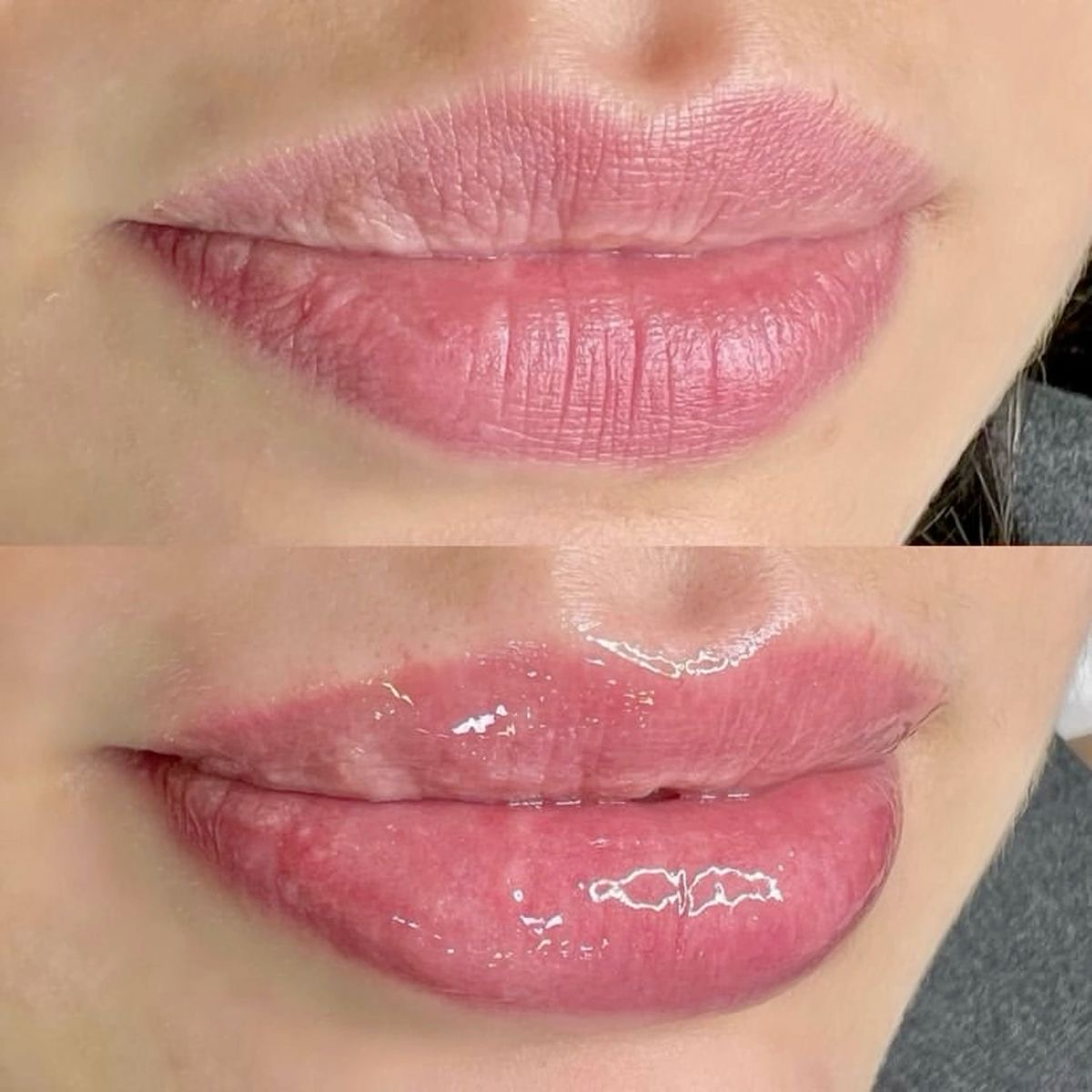 Hydra Gloss